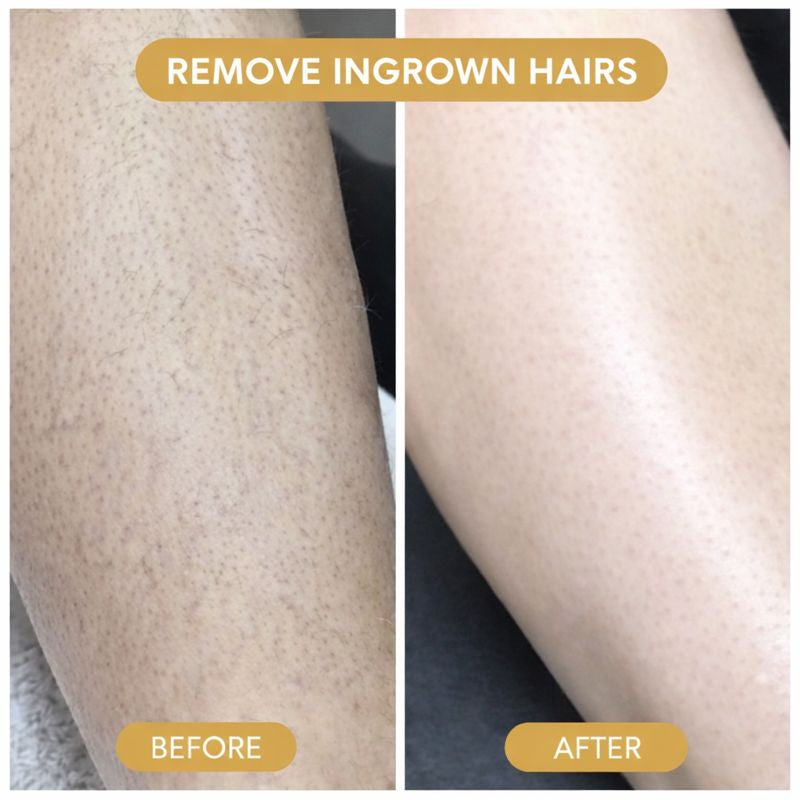 Cyperus Rotundus Skin Serum