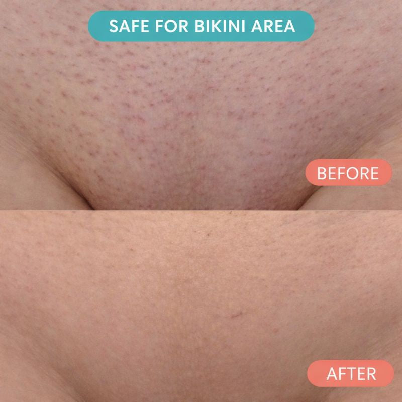 Cyperus Rotundus Skin Serum