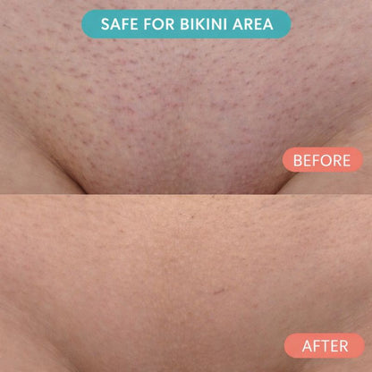 Cyperus Rotundus Skin Serum