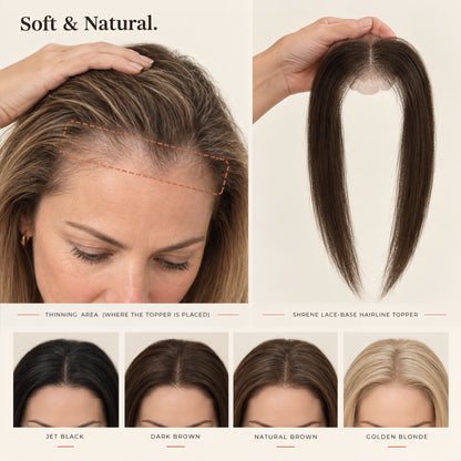 SHRENE™ Hairline Toppers